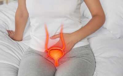 Tips to prevent recurrent cystitis